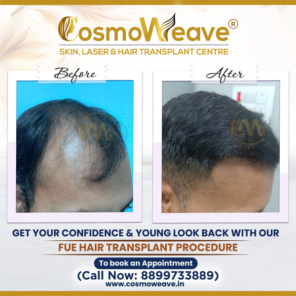 Cover photo of Dr. Mubashar Mashqoor Mir – Dermatologist | Skin, Laser & Hair Specialist at Cosmoweave Jammu